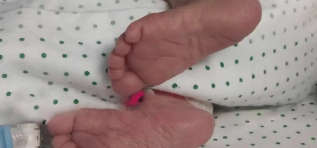 nace-en-el-virgen-del-rocio-un-bebe-operado-de-espina-bifida-foto-hospital-virgen-del-rocio-1024x481