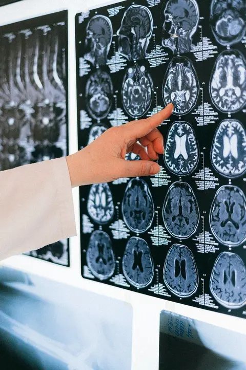 Cerebro