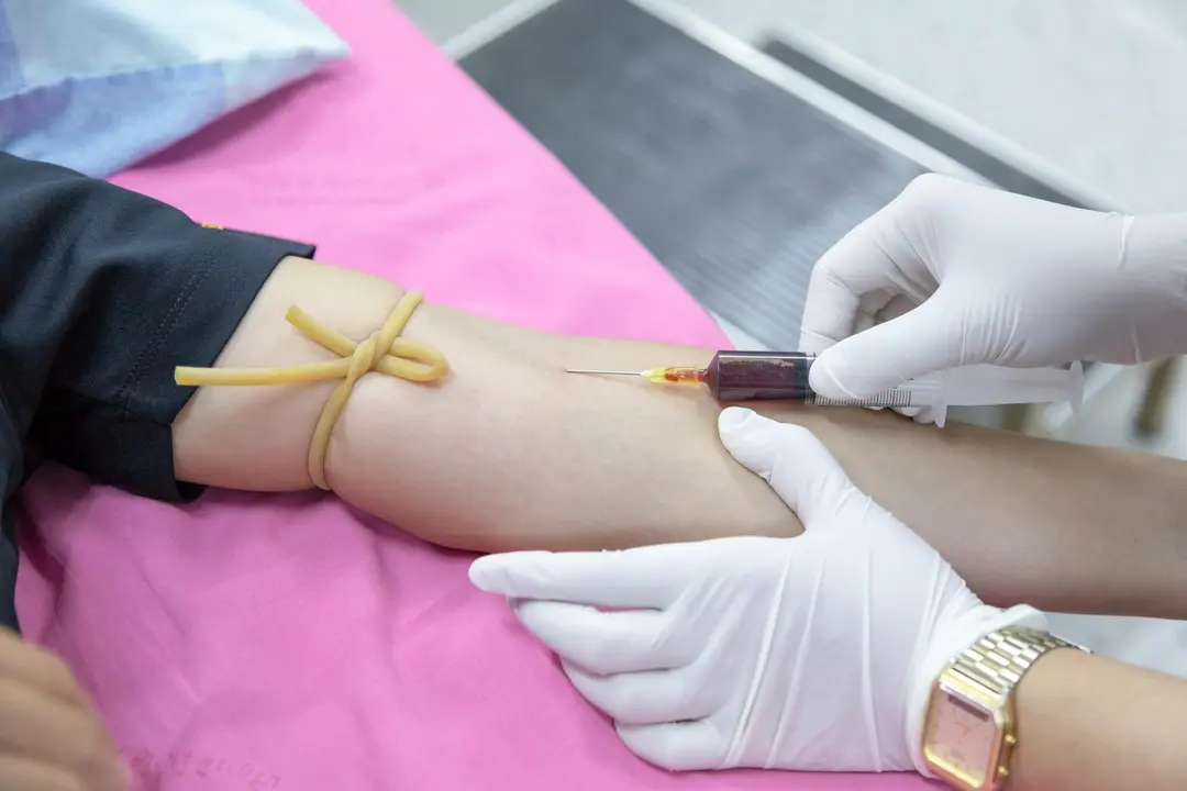 Extracción de sangre