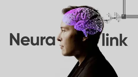 Neuralink