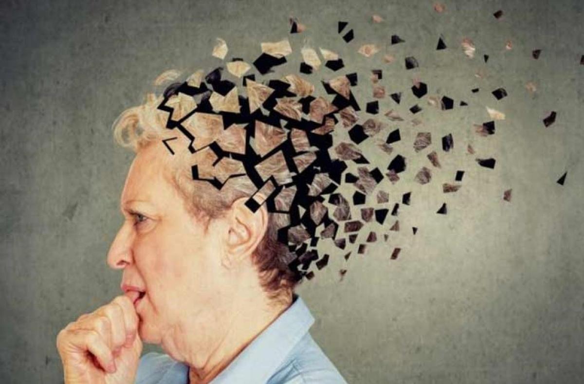 ¡Asombroso! Conoce qué efectos tiene el Fármaco experimental para el Alzheimer